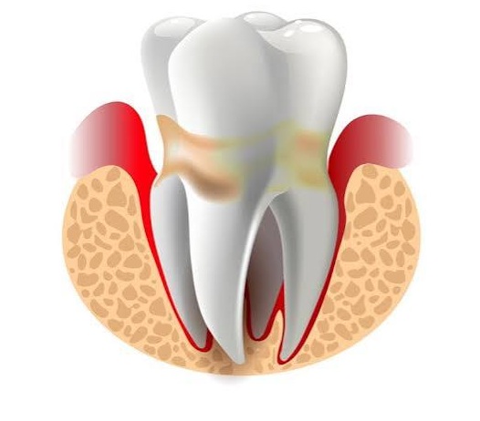 course image